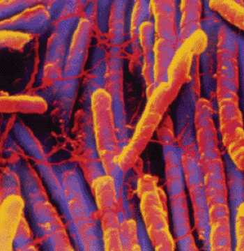 Imagen: Microfotografía electrónica de barrido (SEM) del patógeno Clostridium difficile (Fotografía cortesía de Bioquell).